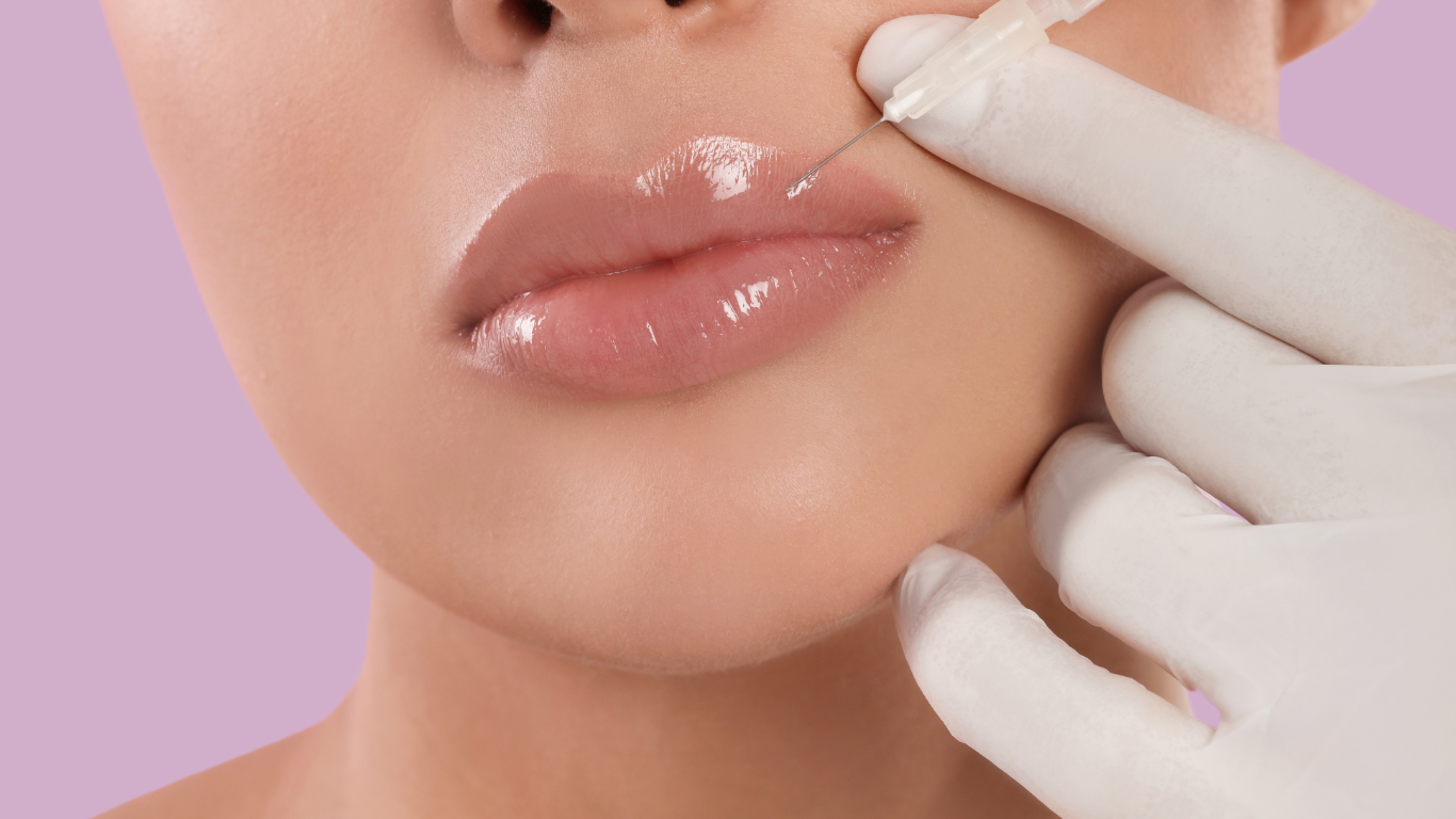 Lippen aufspritzen Kosten Bild Lippen aufspritzen Kosten
