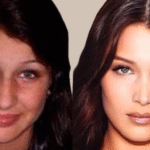 Bella Hadid Nasen-OP: Analyse & Vorher-Nachher-Vergleich