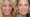 Blake Lively Nasen OP