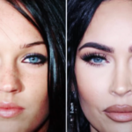 Megan Fox Nasen Op Vorher Nachher