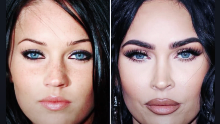 Megan Fox Nasen Op Vorher Nachher