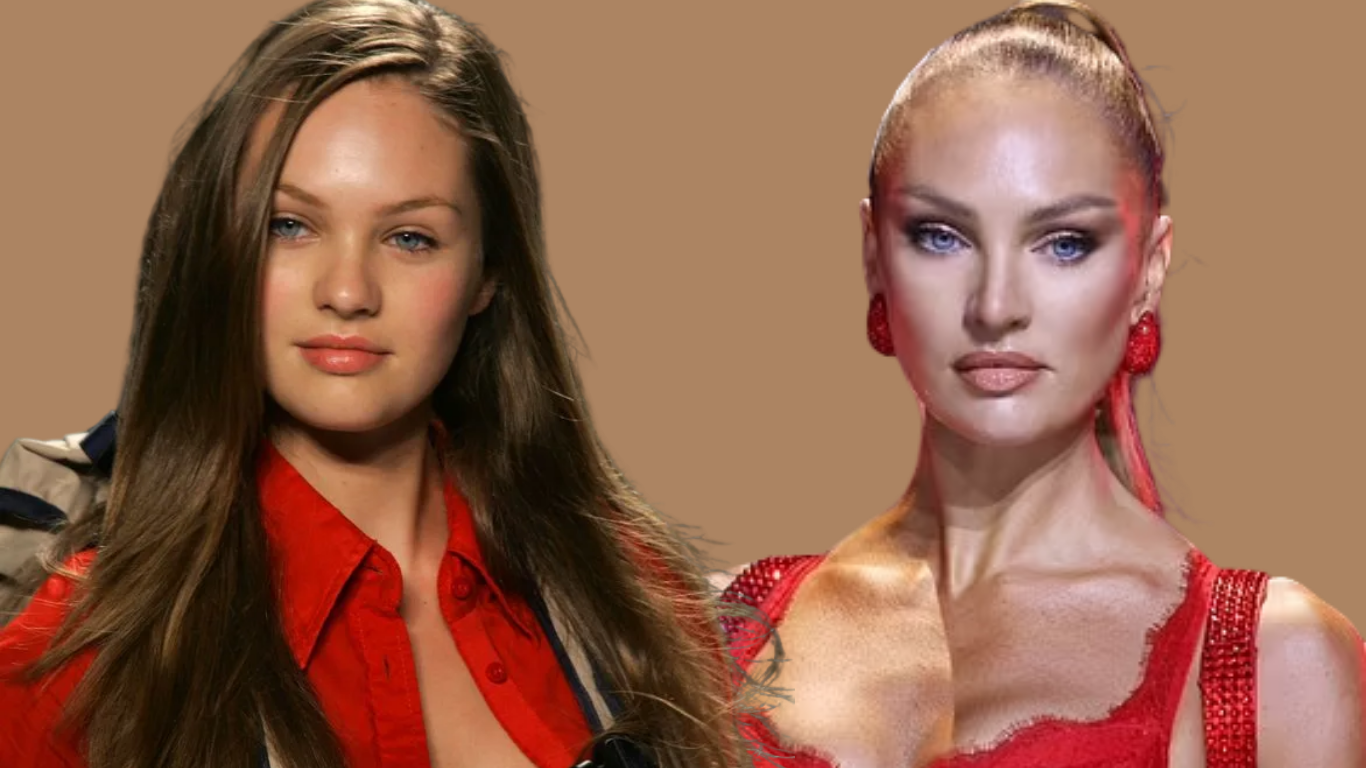 Candice Swanepoel Nase – vorher-nachher im Vergleich