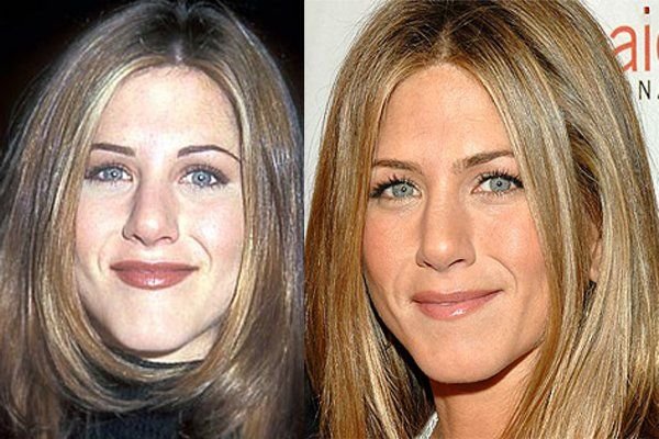 Jennifer Aniston früher: So sah ihre Nase ursprünglich aus