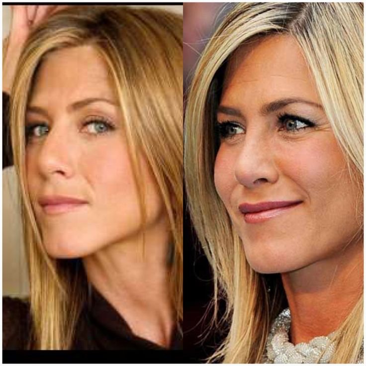 Wann hatte Jennifer Aniston ihre Nasen-OPs?