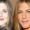 Jennifer Aniston Nasen-OP