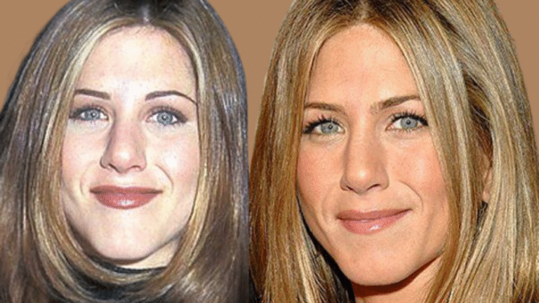 Jennifer Aniston Nasen-OP