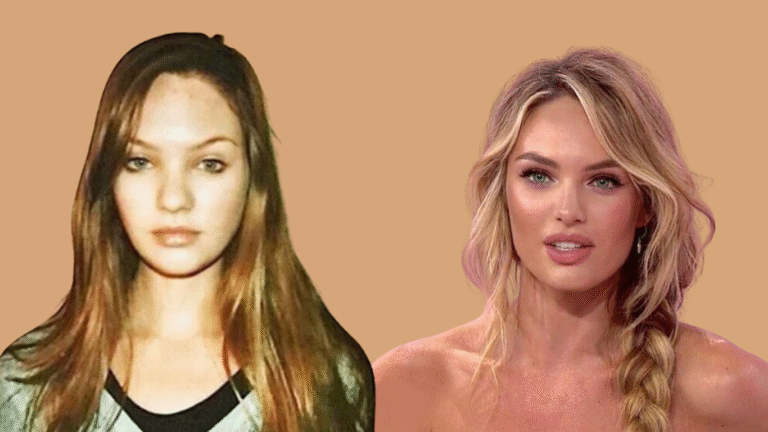 candice swanepoel nasen-OP