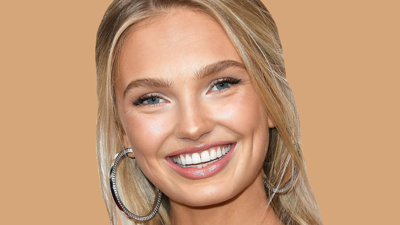 Romee Strijd Nase nachher