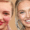 Romee Strijd Nasen-OP – Gerüchte, Fakten & Vorher-Nachher-Analyse
