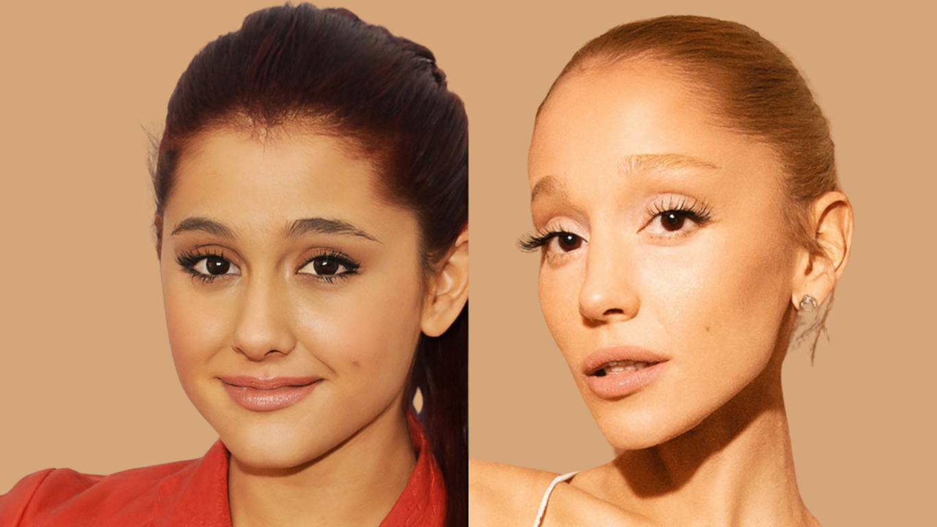 Ariana Grande Nasenoperation