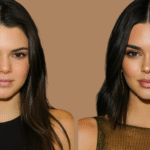 Kendall Jenner Gesicht vorher nachher – Lippen, Wangen, Augenpartie