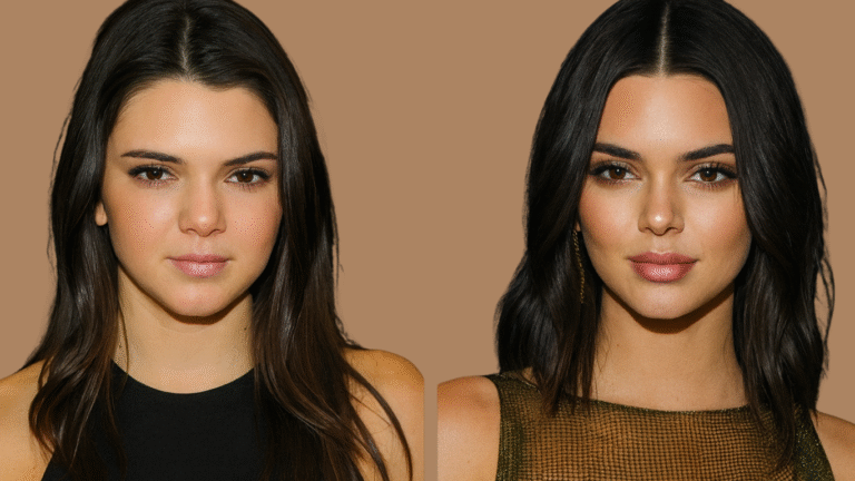 Kendall Jenner Gesicht vorher nachher – Lippen, Wangen, Augenpartie