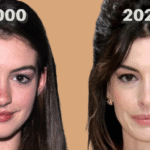 Anne Hathaway Nasen-OP vorher nachher – mögliche Veränderungen der Nasenlinie im Vergleich