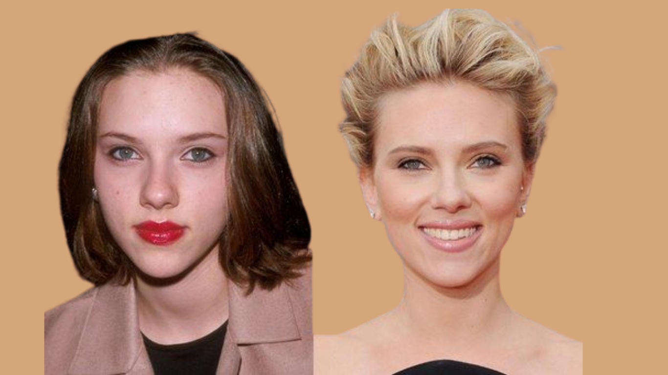 Scarlett Johansson Nasen-OP – Was der Vorher-Nachher-Vergleich zeigt