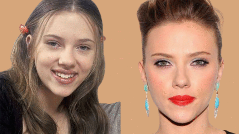 Hat Scarlett Johansson eine Nasen-OP gehabt?